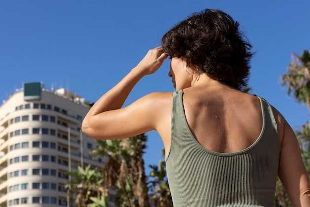 Tips to Prevent Sunburn