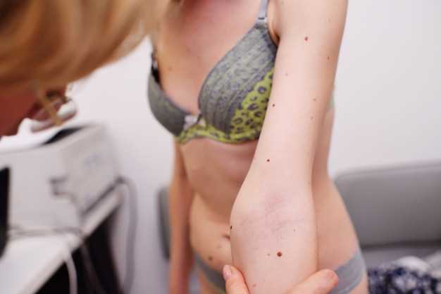 Important Considerations: