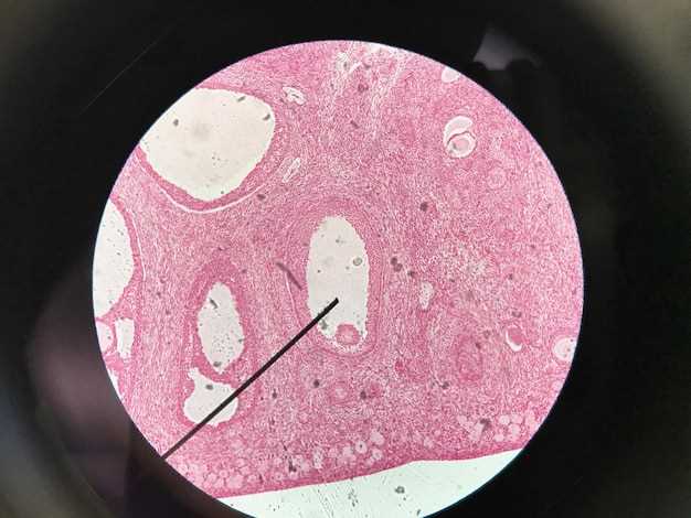 Reduce risk of heart disease