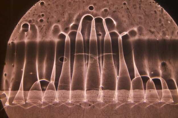 Mechanism of Excretion